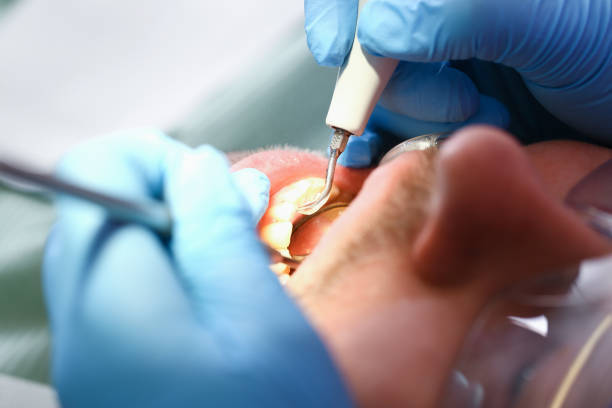 Best Orthodontic Emergency Dentist in Chauvin, LA